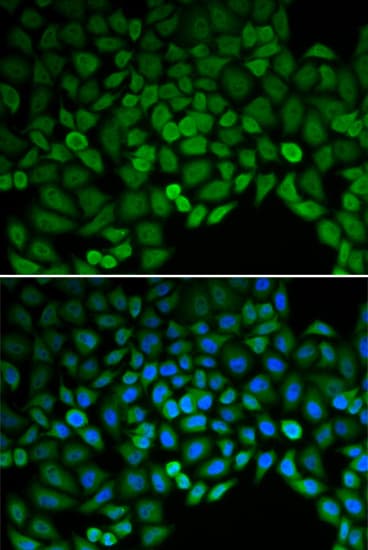 CTNND1 / p120 Catenin Antibody