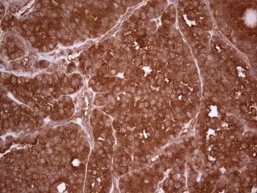 UBE2D2 / UBCH5B Antibody (clone OTI1D11)