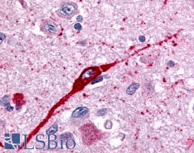 PathPlus™ FFAR2 / GPR43 Antibody (Extracellular Domain)