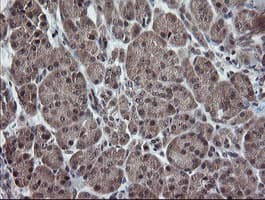 ESRRG / ERR Gamma Antibody (aa24-263, clone OTI1E5)