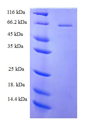 Human PLCZ1 Protein (Recombinant His-SUMO)