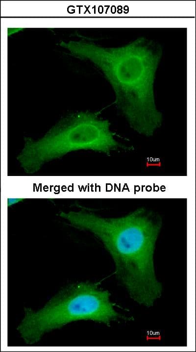 Polyclonal Rabbit anti-Human PDCL Antibody (aa1-244, WB)