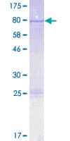 Human PTBP3 / ROD1 Protein (Recombinant GST)