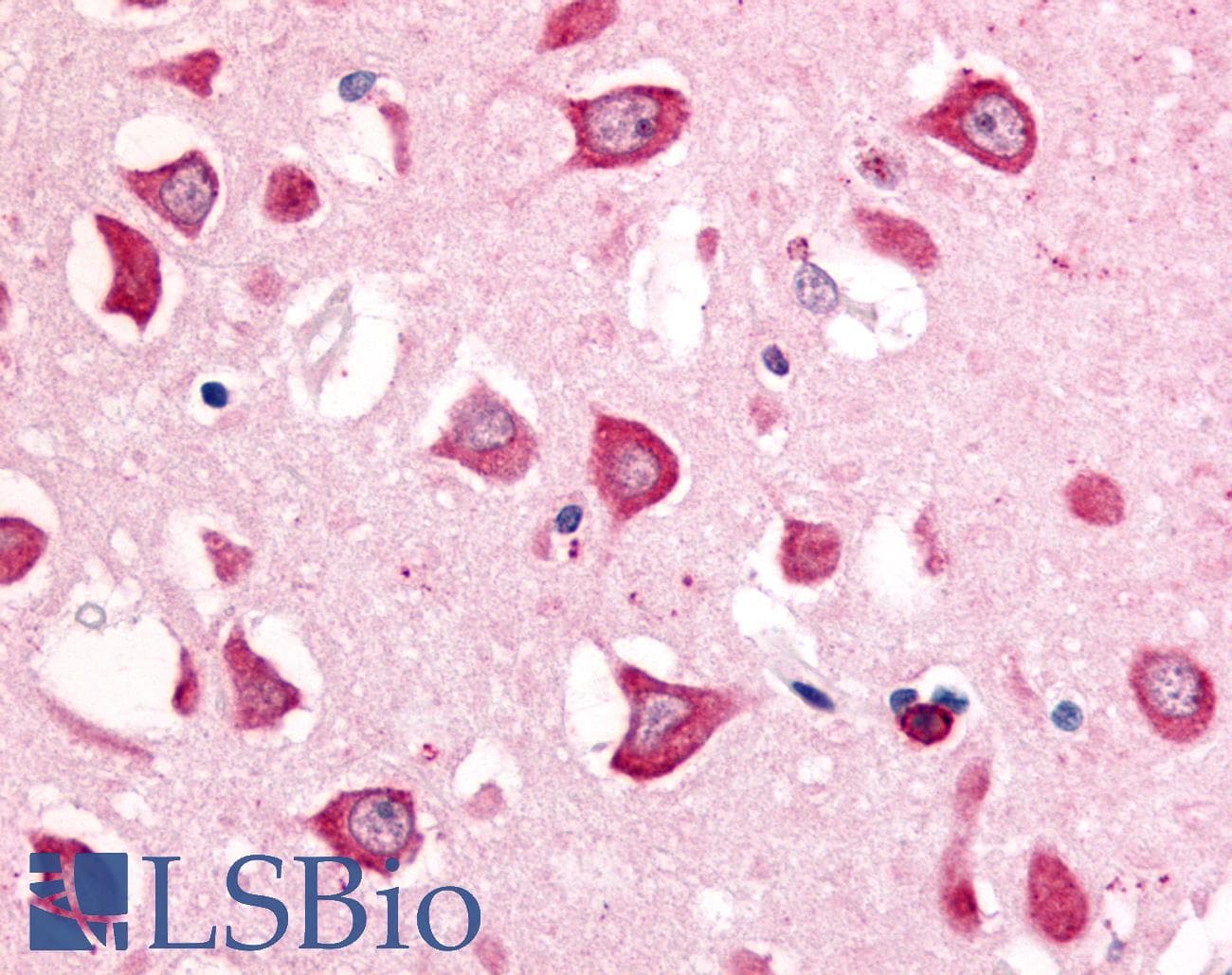 PathPlus™ Polyclonal Rabbit anti-Human MINK1 / MINK Antibody (Internal, IHC)