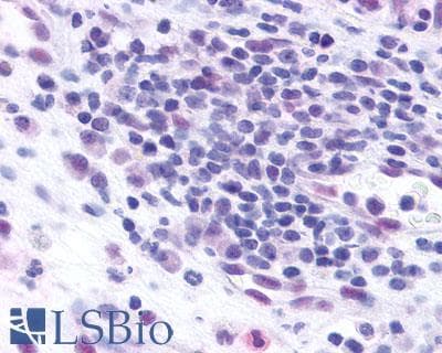 PathPlus™ CCR3 Antibody (C-Terminus)