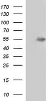 MMP13 Antibody (aa104-471, clone OTI2D11)