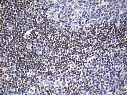 FOXP1 Antibody (clone UMAB242, Carrier-free)