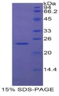 Human EN2 Protein (Recombinant His, N-Terminal)