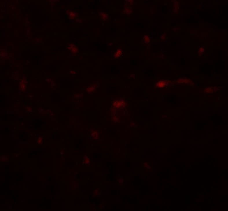 IHC-plus™ TRB3 / TRIB3 Antibody