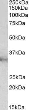 IHC-plus™ Polyclonal Goat anti-Human CLIC1 / NCC27 Antibody (aa71-82, IHC, WB)