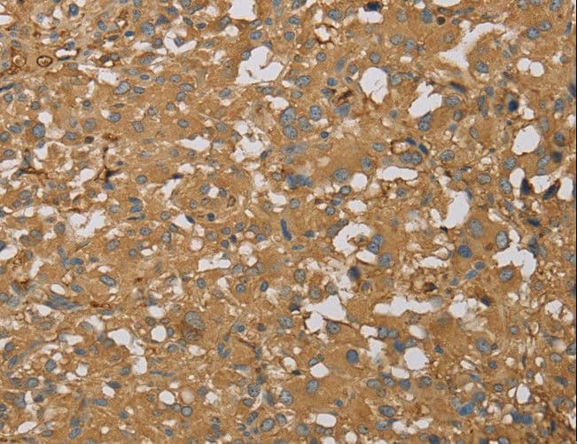 AHSG / Fetuin A Antibody