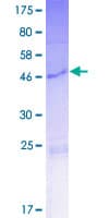 Human KRTAP10-2 Protein (Recombinant GST)