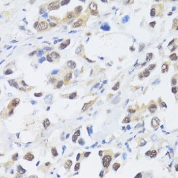 Polyclonal Rabbit anti-Human EP300 / p300 Antibody (IHC, WB)