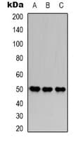 FH / Fumarase / MCL Antibody