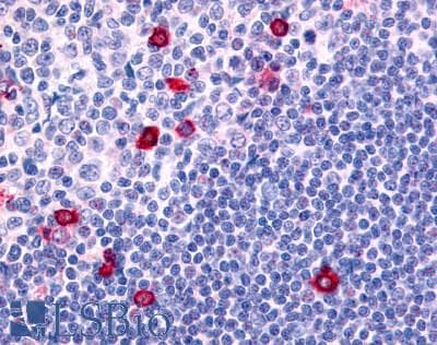 IHC-plus™ Polyclonal Rabbit anti-Human CNR2 / CB2 Antibody (Internal, IHC)