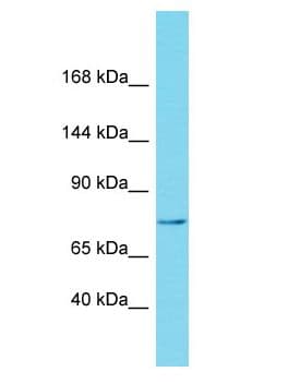 Polyclonal Rabbit anti-Human NBPF15 Antibody (aa159-208, WB)