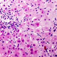 Polyclonal Rabbit anti-Human CCP110 Antibody (C-Terminus, IHC, WB)