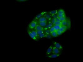 Monoclonal Mouse anti-Human NPR3 Antibody (clone OTI11H6, IHC, IF, WB)