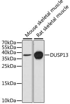 DUSP13 Antibody