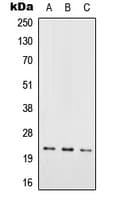 Polyclonal Rabbit anti-Human RAB29 / RAB7L1 Antibody (Internal, WB)