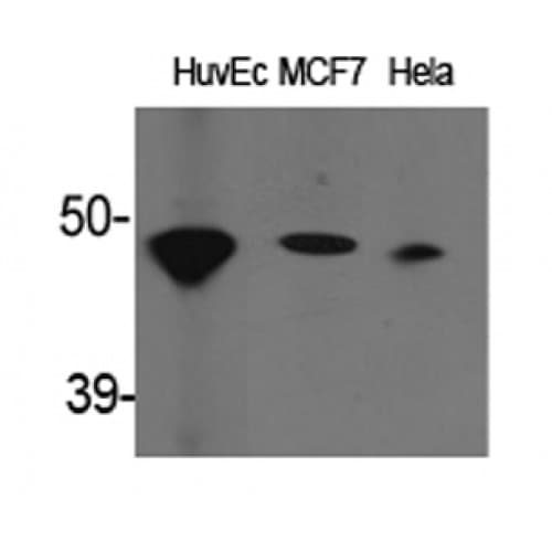 ACAT1 Antibody (190-270 aa, Internal)