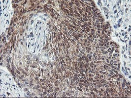 Monoclonal Mouse anti-Human COASY Antibody (clone OTI2H1, IHC, WB)