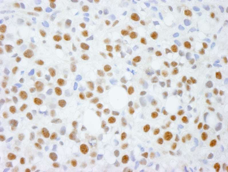 ADNP Antibody (aa1050-C-term)