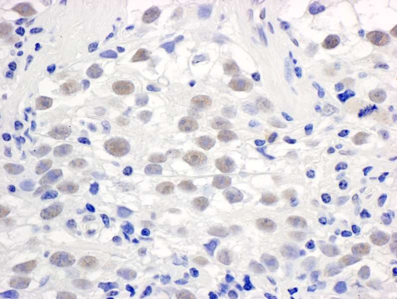 PELP1 Antibody (aa25-75)