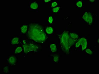 ZIC4 Antibody