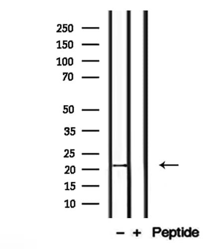 Polyclonal Rabbit anti-Human CTAG2 Antibody (WB)