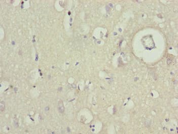 BCAS3 Antibody