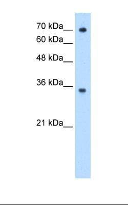 FCGRT / FCRN Antibody (aa51-100)