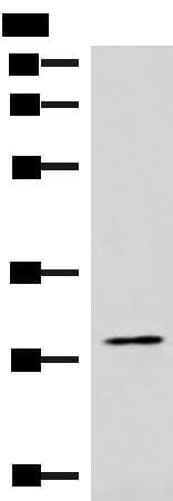 CDK4 Antibody