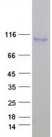 Human ELP2 / STATIP1 Protein (Recombinant Myc-DDK (Flag))