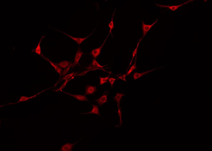 Polyclonal Rabbit anti-Human VASP Antibody (IHC, IF, WB)