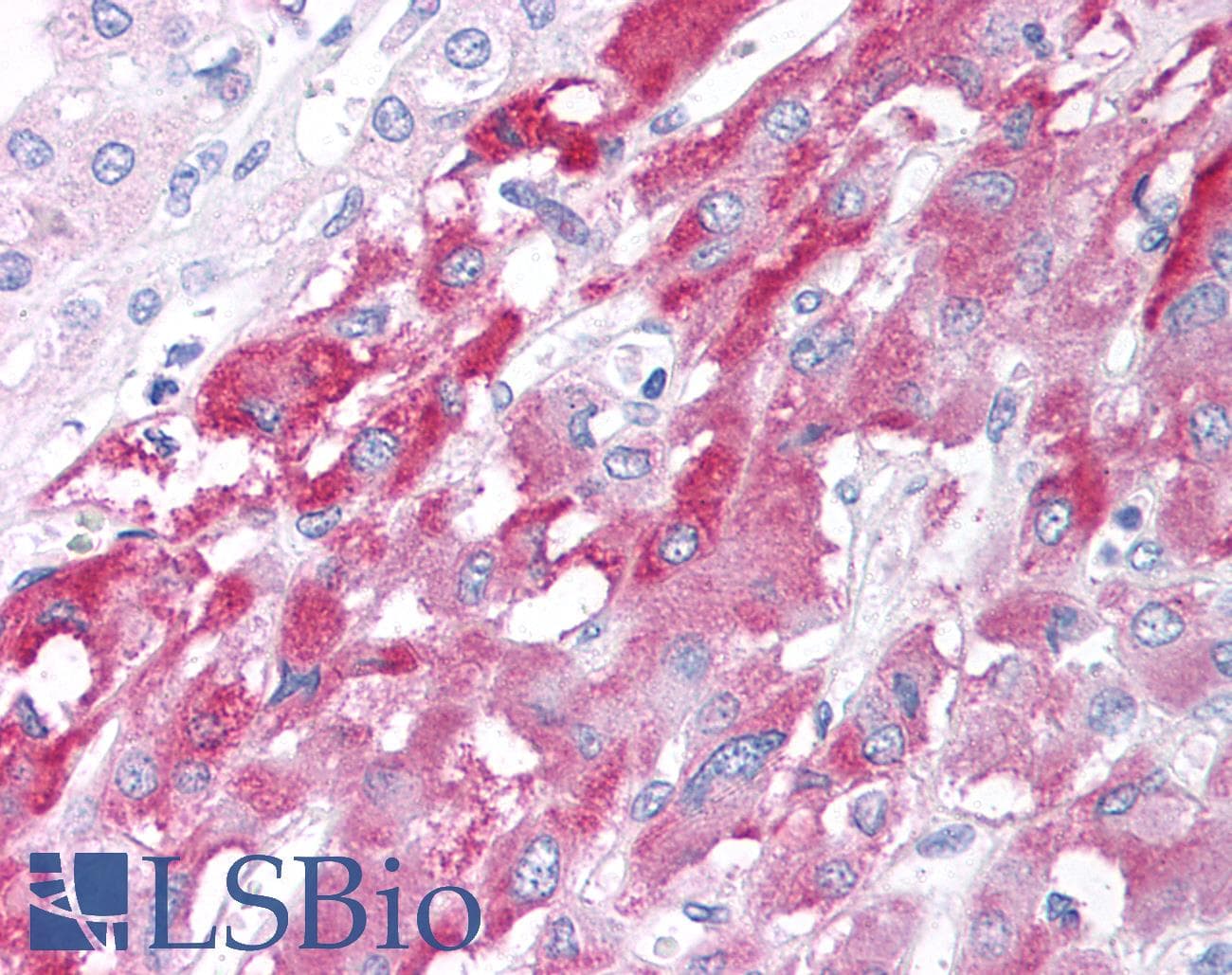 IHC-plus™ HAP1 Antibody (aa639-653)