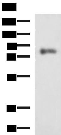 PRKCSH Antibody