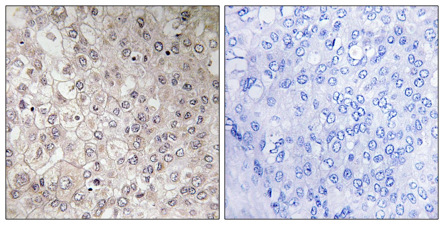 Polyclonal Rabbit anti-Human GIPR / GIP Receptor Antibody (IHC, IF)