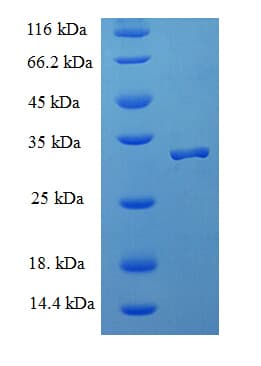 Human AIF1 / IBA1 Protein (Recombinant His-SUMO)