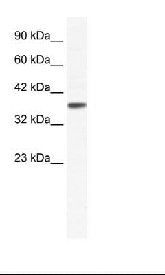 KCNK3 / OAT1 Antibody (C-Terminus)