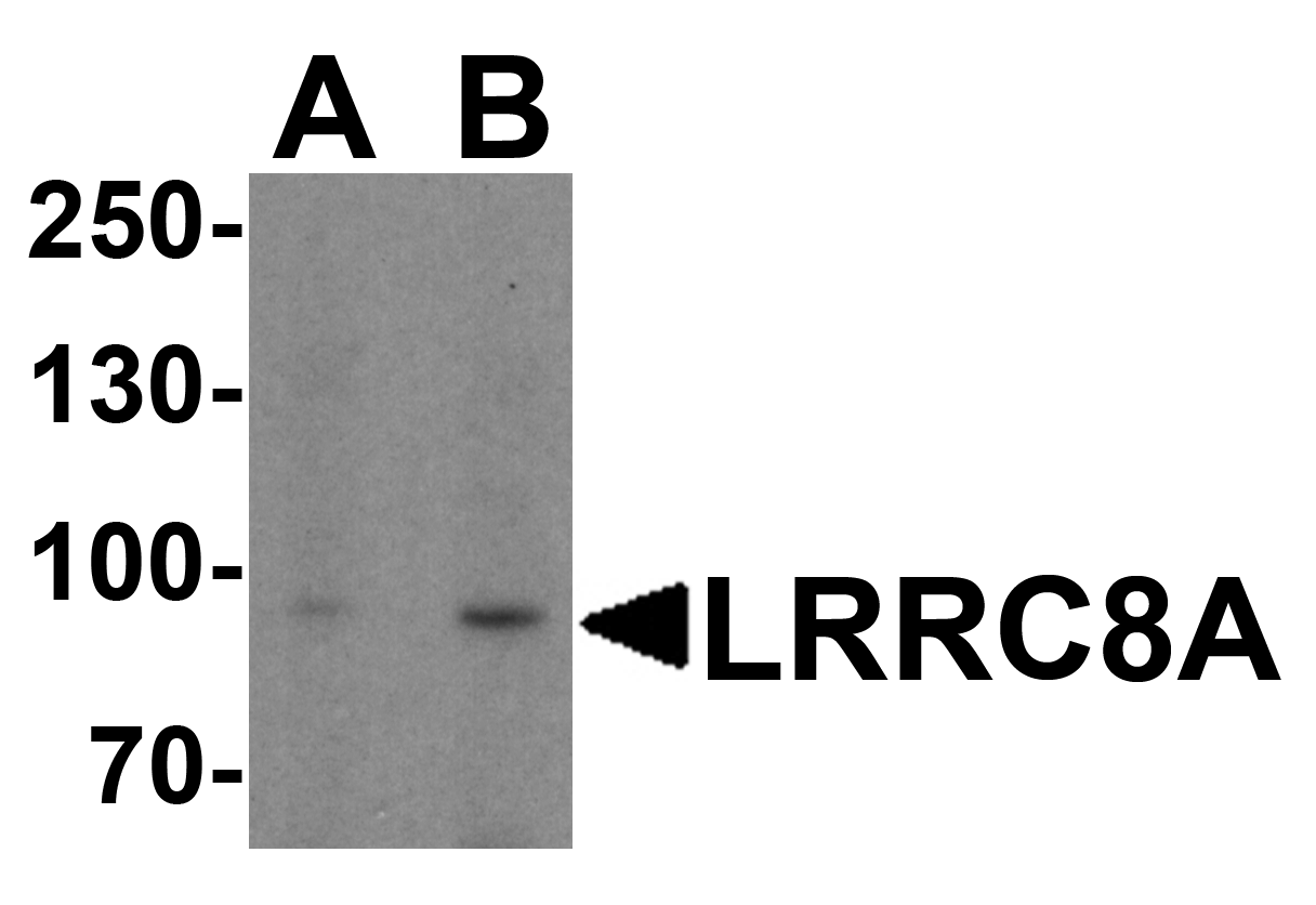 IHC-plus™ LRRC8A / LRRC8 Antibody