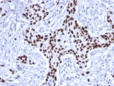 PathPlus™ TP53 / p53 Antibody (clone rTP53/1739)