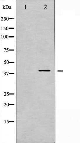 Polyclonal Rabbit anti-Human MAP2K3 / MEK3 / MKK3 Antibody (phospho-Ser189, IHC, IF, WB)