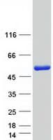 Human NARF Protein (Recombinant Myc-DDK (Flag))