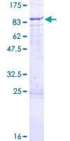Human MARS2 Protein (Recombinant GST)