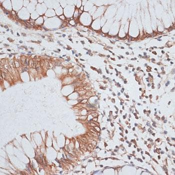 HSET / KIFC1 Antibody