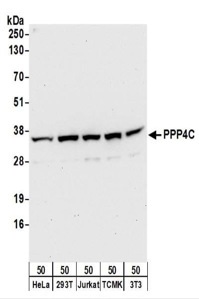 PPP4C Antibody (aa1-50)