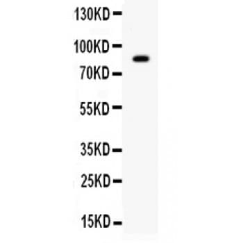 Polyclonal Rabbit anti-Human SMURF2 Antibody (aa317-351, WB)