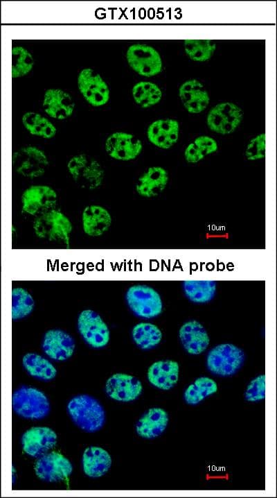 IHC-plus™ Polyclonal Rabbit anti-Human HDAC1 Antibody (IHC, IF, WB)