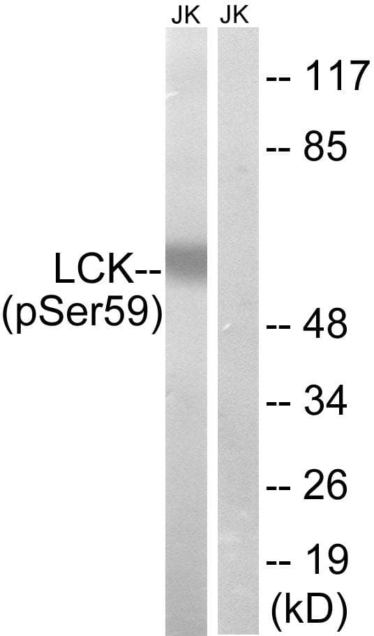 p56lck / LCK Antibody (phospho-Ser59)